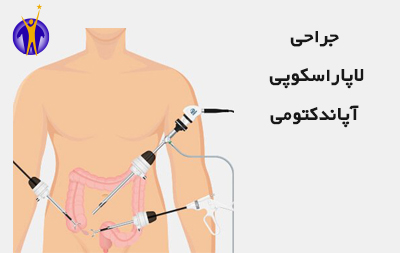 جراحی لاپاراسکوپی آپاندکتومی