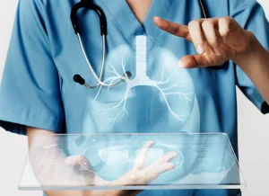 بروز آمبولی در جراحی اسلیو معده