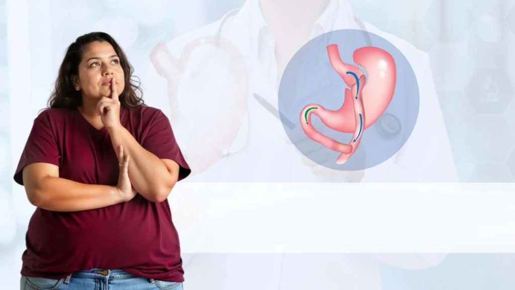 بای پس معده-بهترین جراح چاقی و جراح اسلیو- دکتر طالبیان