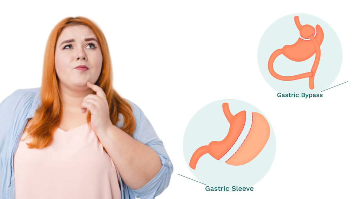 بای پس معده-بهترین جراح چاقی و جراح اسلیو- دکتر طالبیان