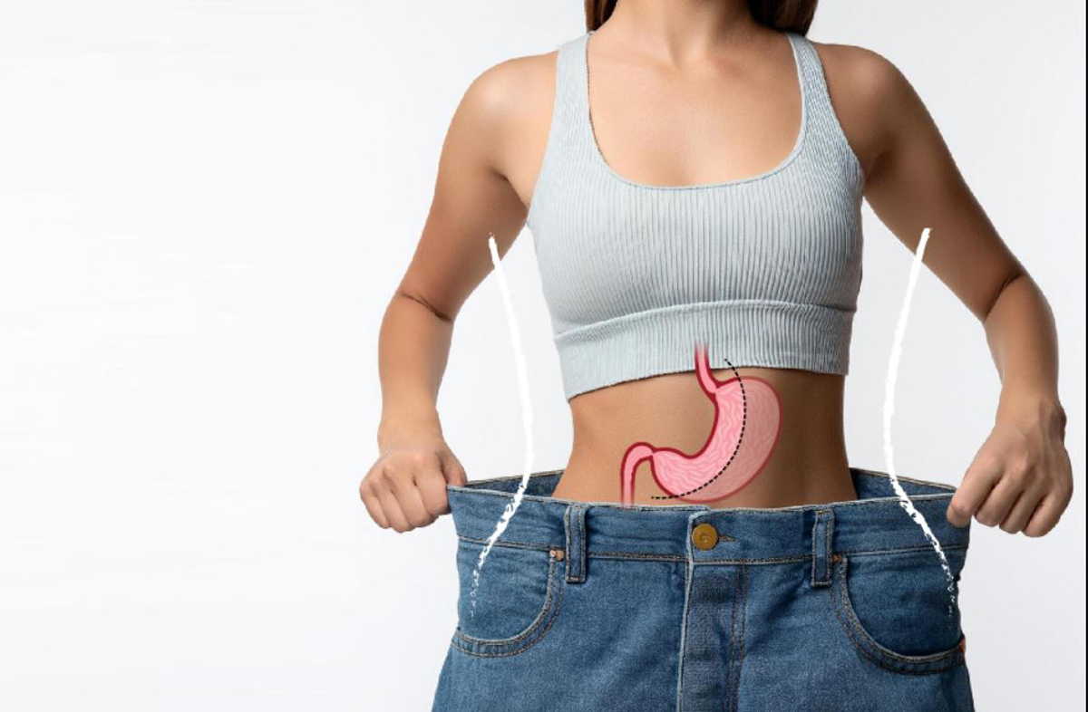 اسلیو معده -بهترین جراح چاقی و جراح اسلیو- دکتر طالبیان