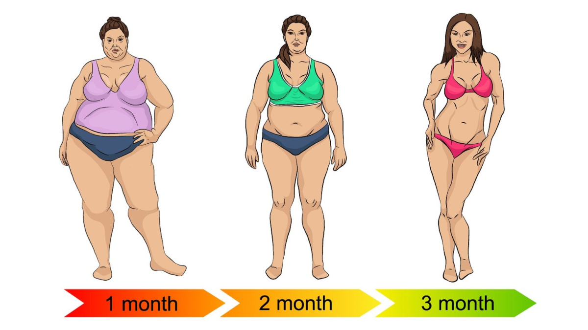 عوارض-جراحی-لاغری-بهترین-جراح-اسلیو-دکتر-طالبیان