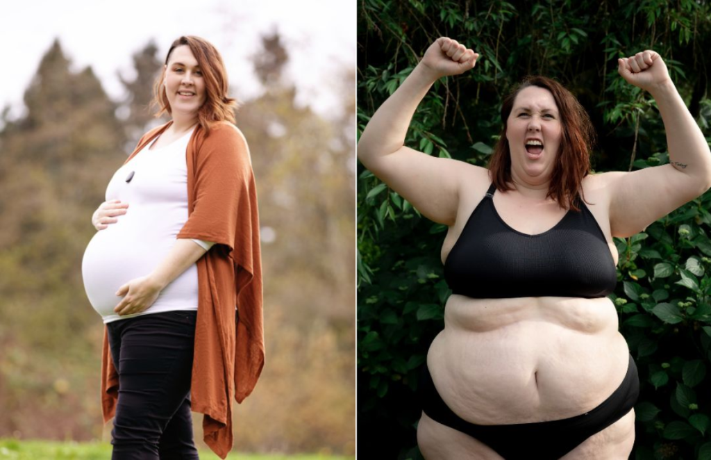 تاثیر چاقی بر ناباروری- دکتر پدرام طالبیان- بهترین جراح چاقی