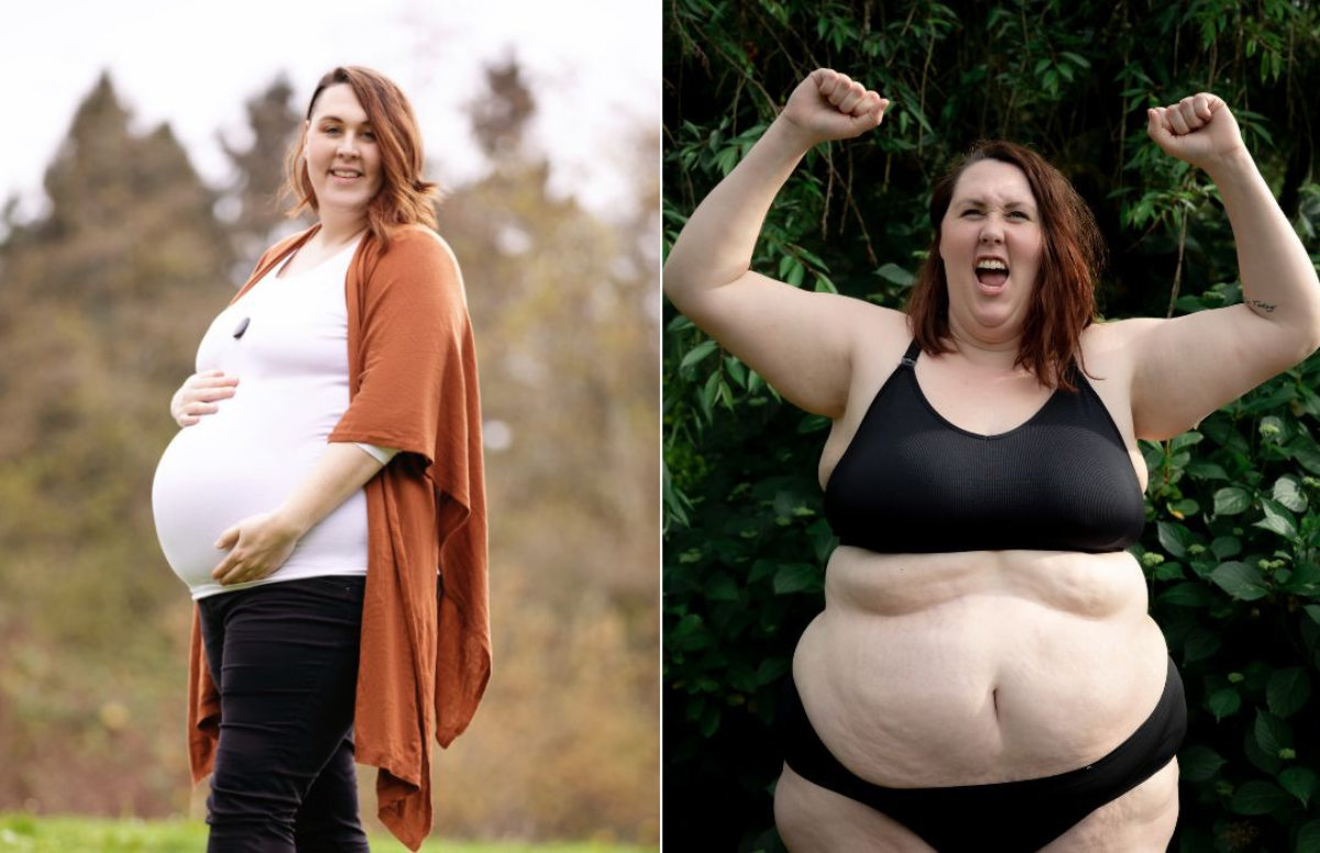 تاثیر چاقی بر ناباروری- دکتر پدرام طالبیان- بهترین جراح چاقی