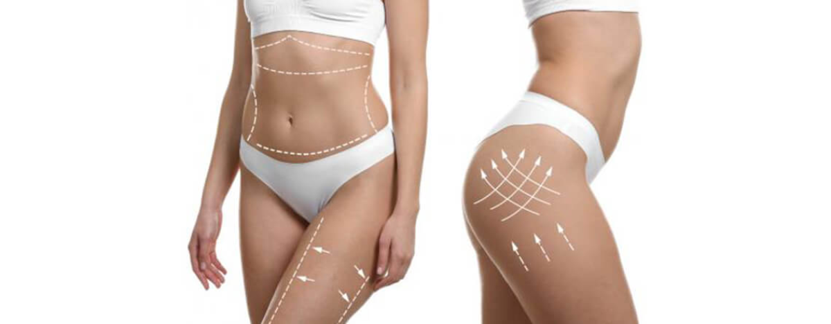  چاقی-موضعی- بهترین-جراح-چاقی-دکتر-طالبیان-