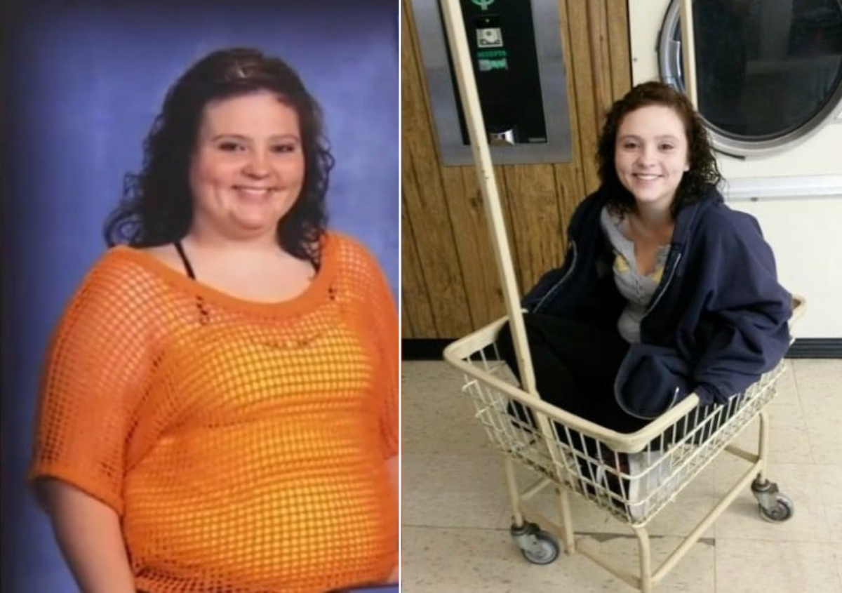 جراحی چاقی در نوجوانان- بهترین جراح چاقی- دکتر طالبیان