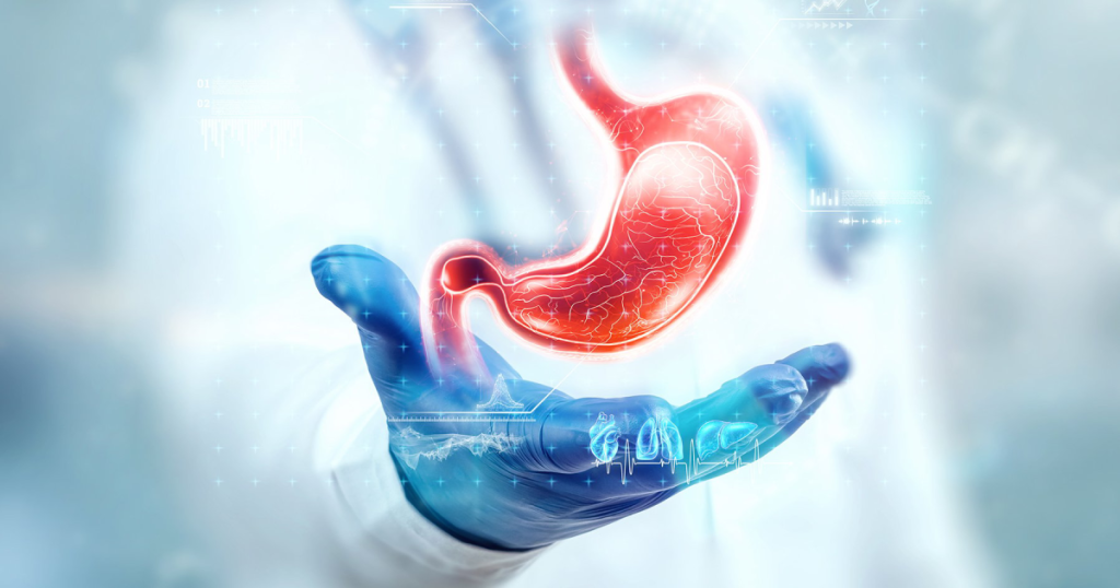 اسلیو معده رایگان- دکتر طالبیان- بهترین جراحی چاقی
